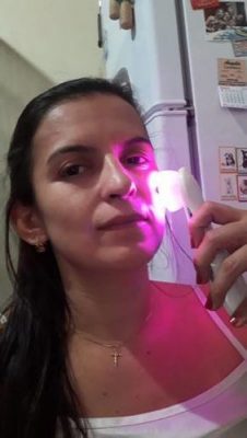 5 in 1 LED Skin Tightening Massager photo review