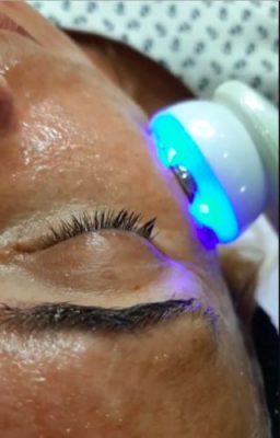 5 in 1 LED Skin Tightening Massager photo review