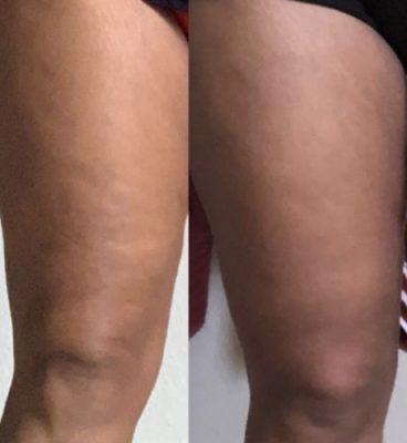 #1 Effective Fat Burning Machine + FREE Slimming Gel photo review