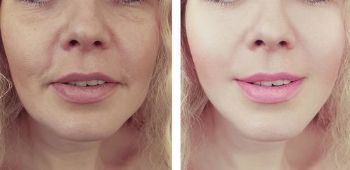#1 Effective Fat Burning Machine + FREE Slimming Gel photo review