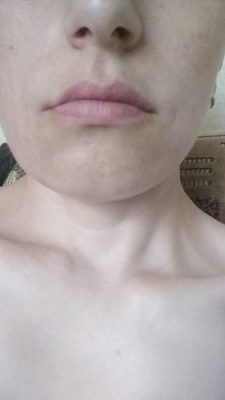 5 in 1 LED Skin Tightening Massager photo review