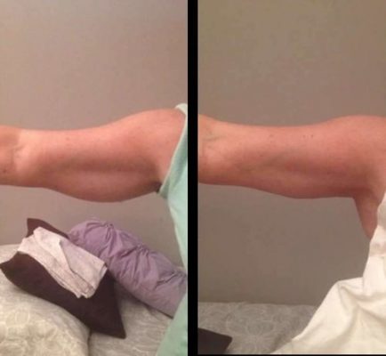 #1 Effective Fat Burning Machine + FREE Slimming Gel photo review