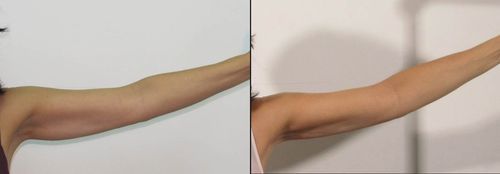 #1 Effective Fat Burning Machine + FREE Slimming Gel photo review